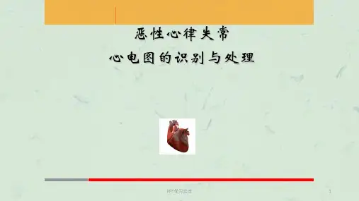 恶性心律失常心电图的识别与处理ppt课件
