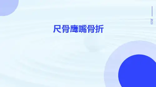 尺骨鹰嘴骨折