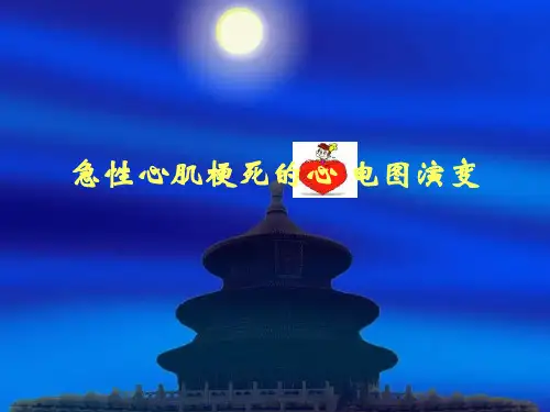 急性心肌梗死的心电图演变