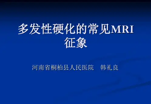 脑多发性硬化的MRI表现