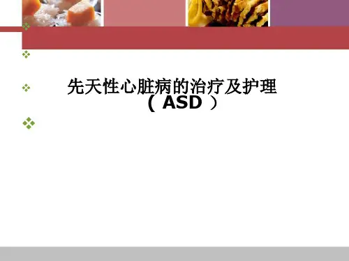 先天性心脏病(ASD)
