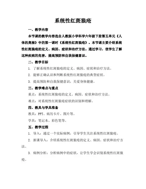 系统性红斑狼疮