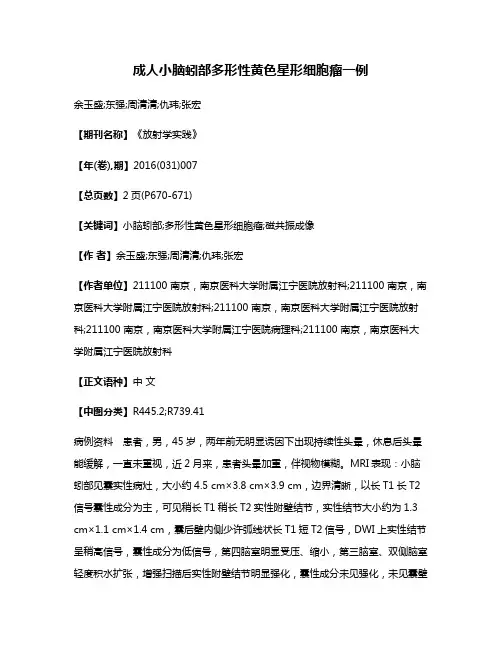 成人小脑蚓部多形性黄色星形细胞瘤一例