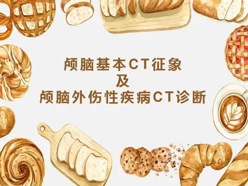 颅脑基本CT征象及颅脑外伤性疾病CT诊断