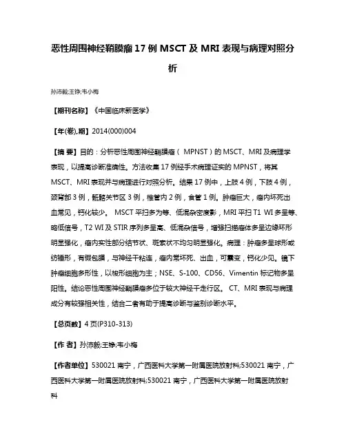 恶性周围神经鞘膜瘤17例 MSCT 及 MRI 表现与病理对照分析