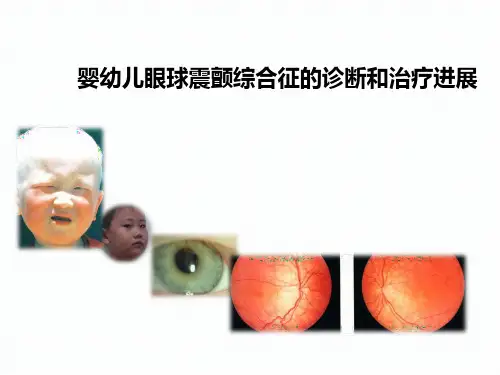 眼球震颤PPT课件