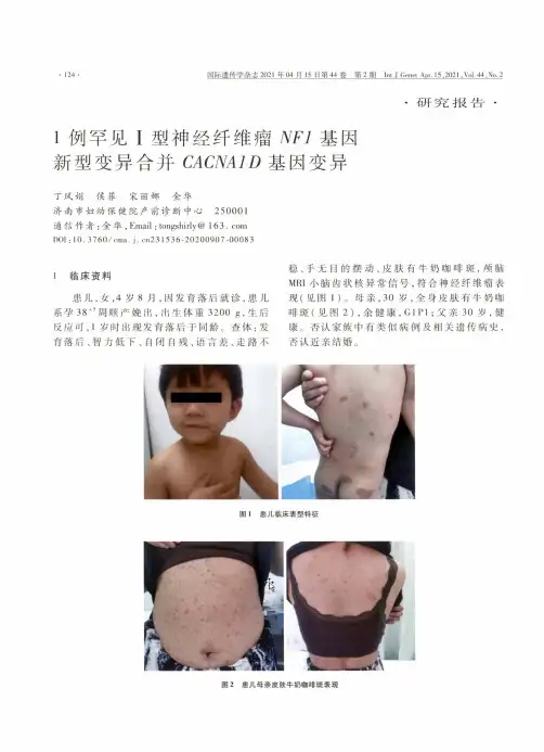 1例罕见Ⅰ型神经纤维瘤NF1基因新型变异合并CACNA1D基因变异