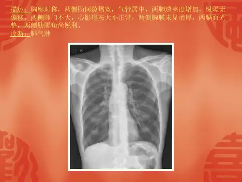 常见40张X片读片及诊断