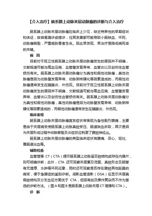 【介入治疗】肠系膜上动脉夹层动脉瘤的诊断与介入治疗