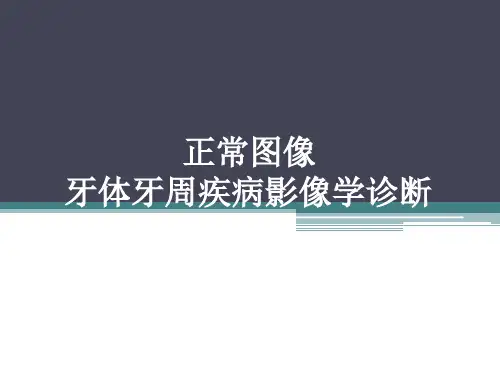 口腔影像学：正常图像,牙体牙周疾病影像学诊断