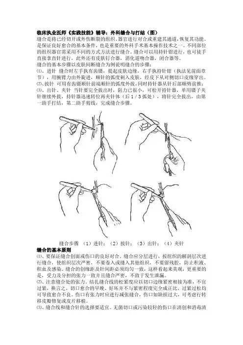 外科缝合与打结