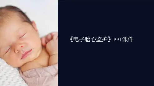 《电子胎心监护》课件