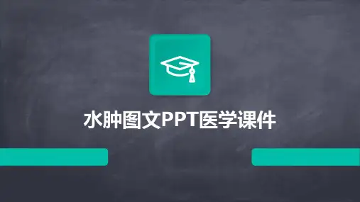 水肿图文PPT医学课件