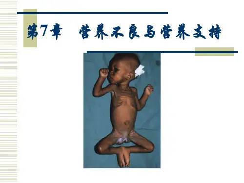 营养学基础第7章 营养不良与营养支持