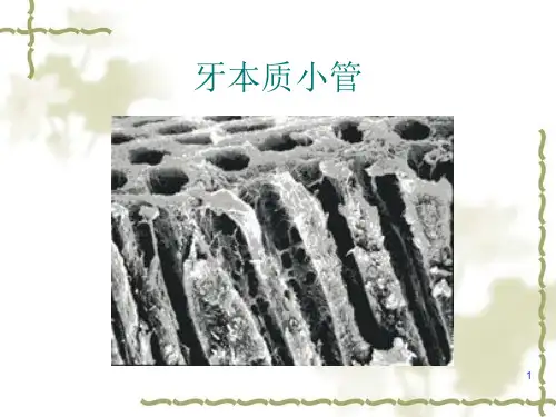 牙本质封闭