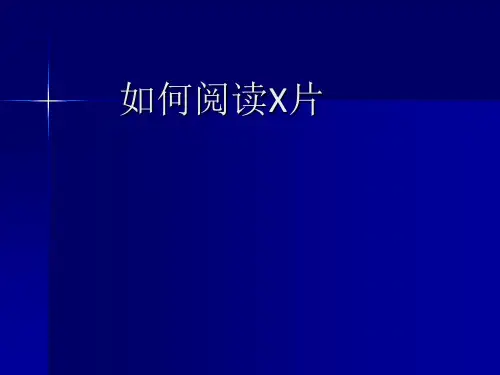 如何阅读X片