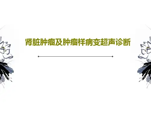 肾脏肿瘤及肿瘤样病变超声诊断56页PPT