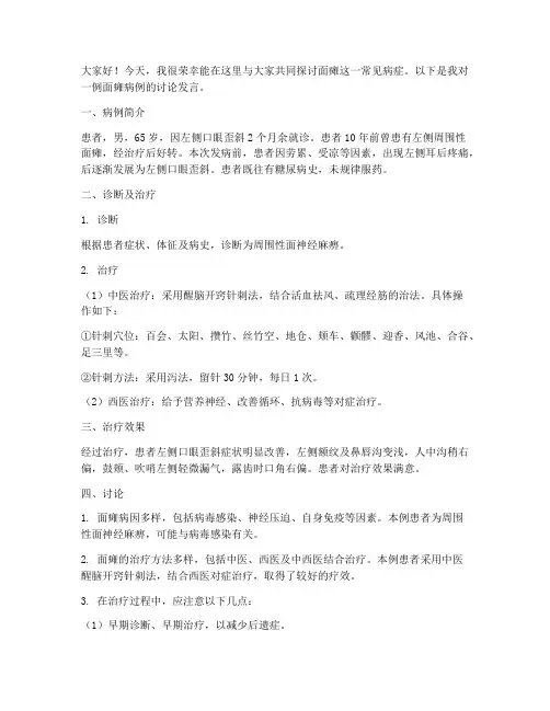 面瘫案例讨论发言稿范文