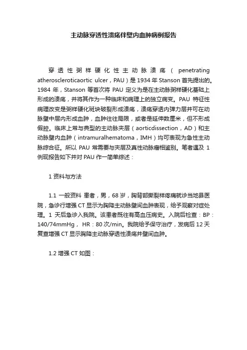主动脉穿透性溃疡伴壁内血肿病例报告
