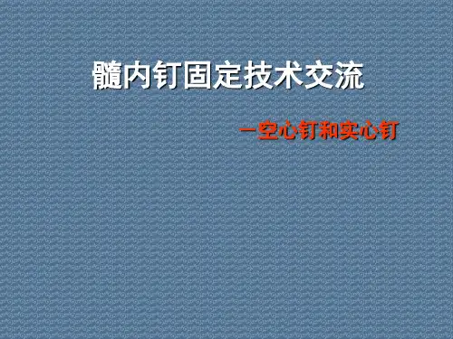 髓内钉固定技术交流-空心钉和实心钉