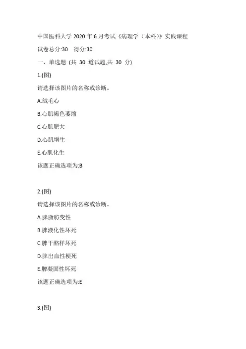 中国医科大学2020年6月考试《病理学》本科实践课程学习资料