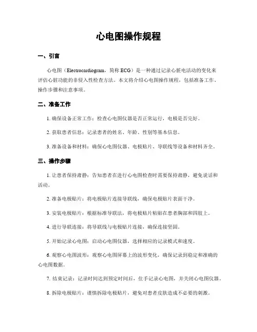 心电图操作规程