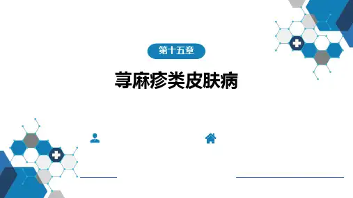 皮肤性病学 第15-16章  荨麻疹类皮肤病与药疹