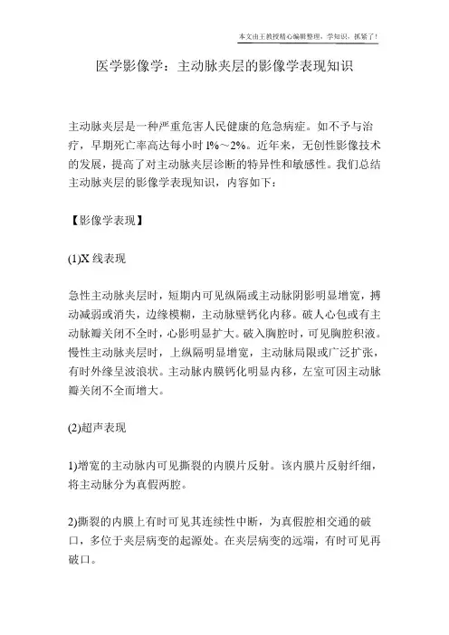 医学影像学：主动脉夹层的影像学表现知识