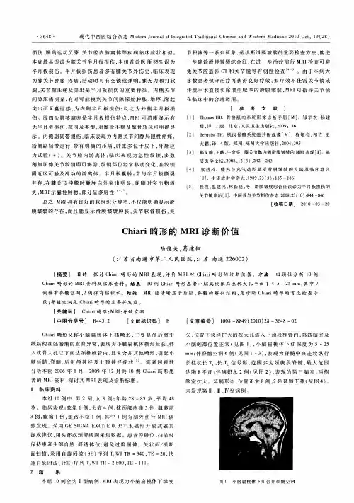 Chiari畸形的MRI诊断价值