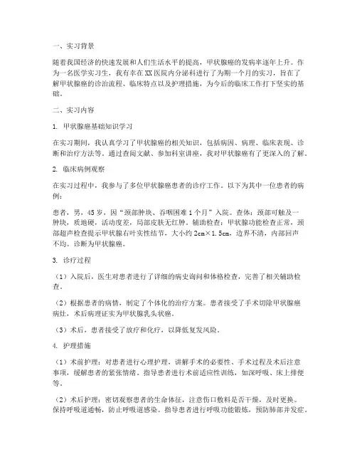 甲状腺癌实习报告