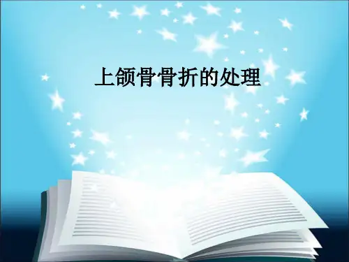 上颌骨骨折的处理ppt课件