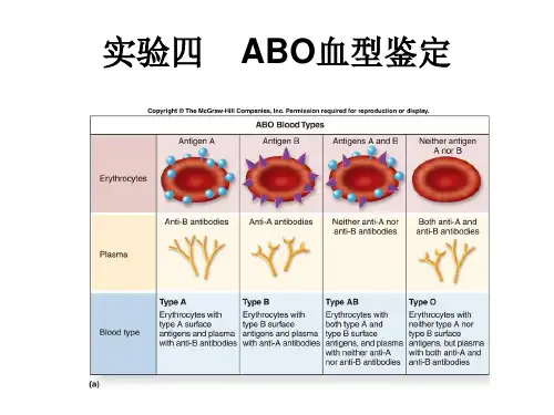ABO血型鉴定