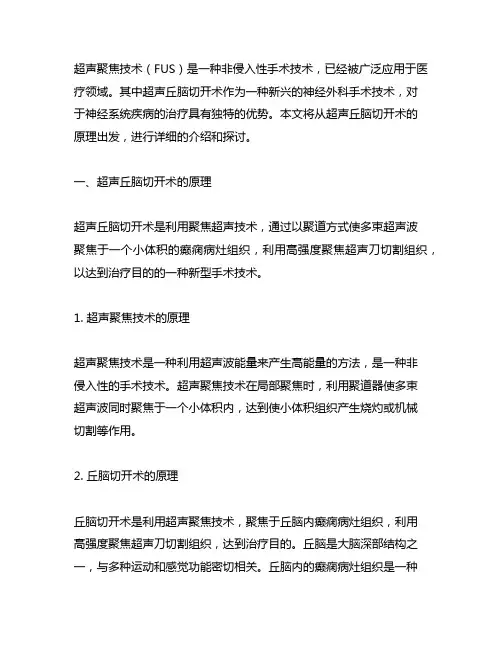 聚焦超声(fus)丘脑切开术原理