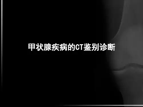 甲状腺结节的CT诊断模板