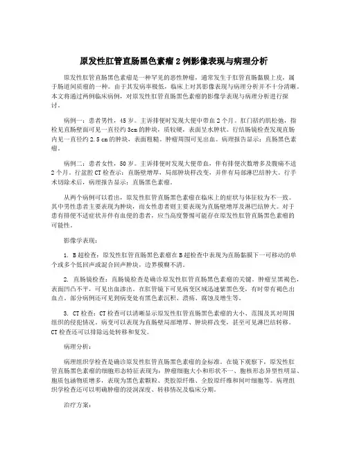 原发性肛管直肠黑色素瘤2例影像表现与病理分析