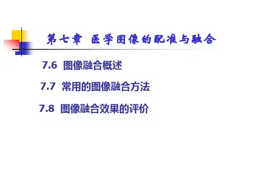 第七章医学图像的配准与融合