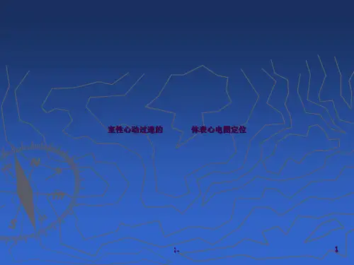 室性心动过速的体表心电图定位_ppt课件