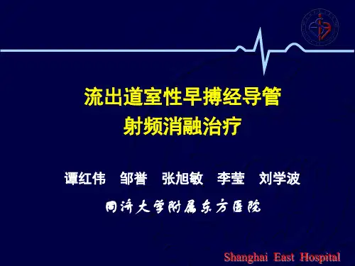 流出道室性早搏导管射频消融治疗ppt课件