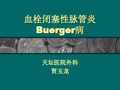 血栓闭塞性脉管炎Buerger病20页PPT