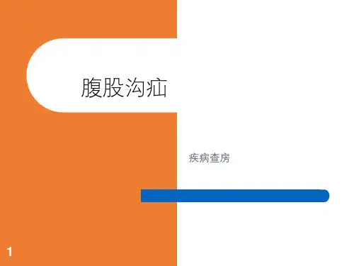 腹股沟疝PPT课件