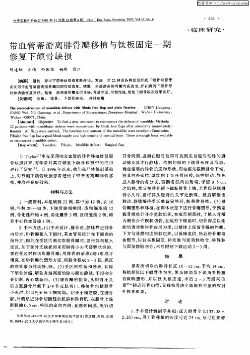 带血管蒂游离腓骨瓣移植与钛板固定一期修复下颌骨缺损