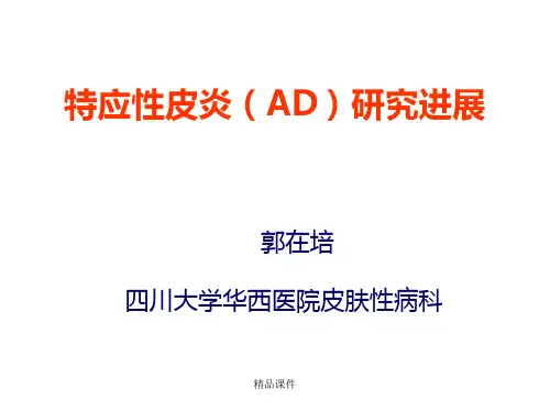 特应性皮炎(AD)研究进展