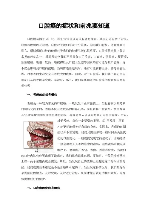 口腔癌的症状和前兆要知道