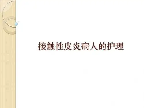 接触性皮炎病人的护理ppt课件