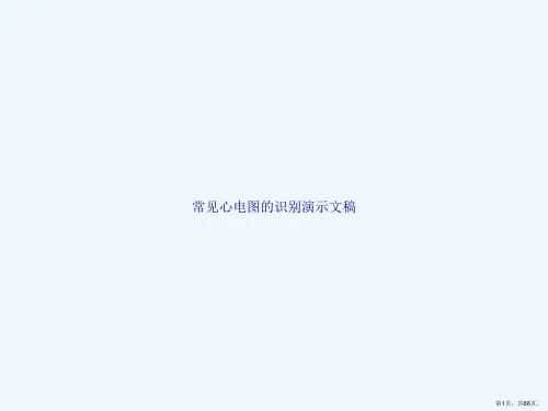常见心电图的识别演示文稿