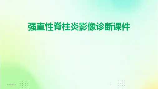 2024年度强直性脊柱炎影像诊断课件