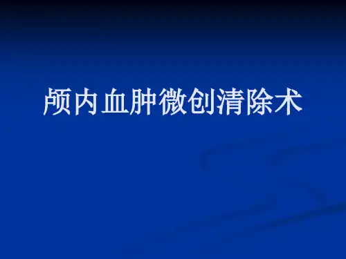 颅内血肿微创清除术适应症及步骤