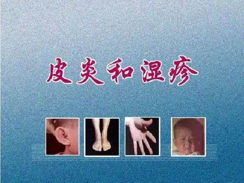 皮肤病：皮炎和湿疹