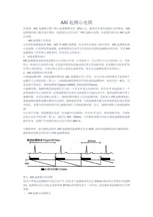 AAI起搏心电图