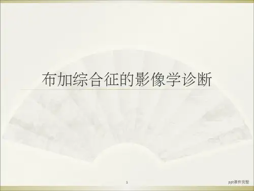 布加综合征的影像诊断ppt课件